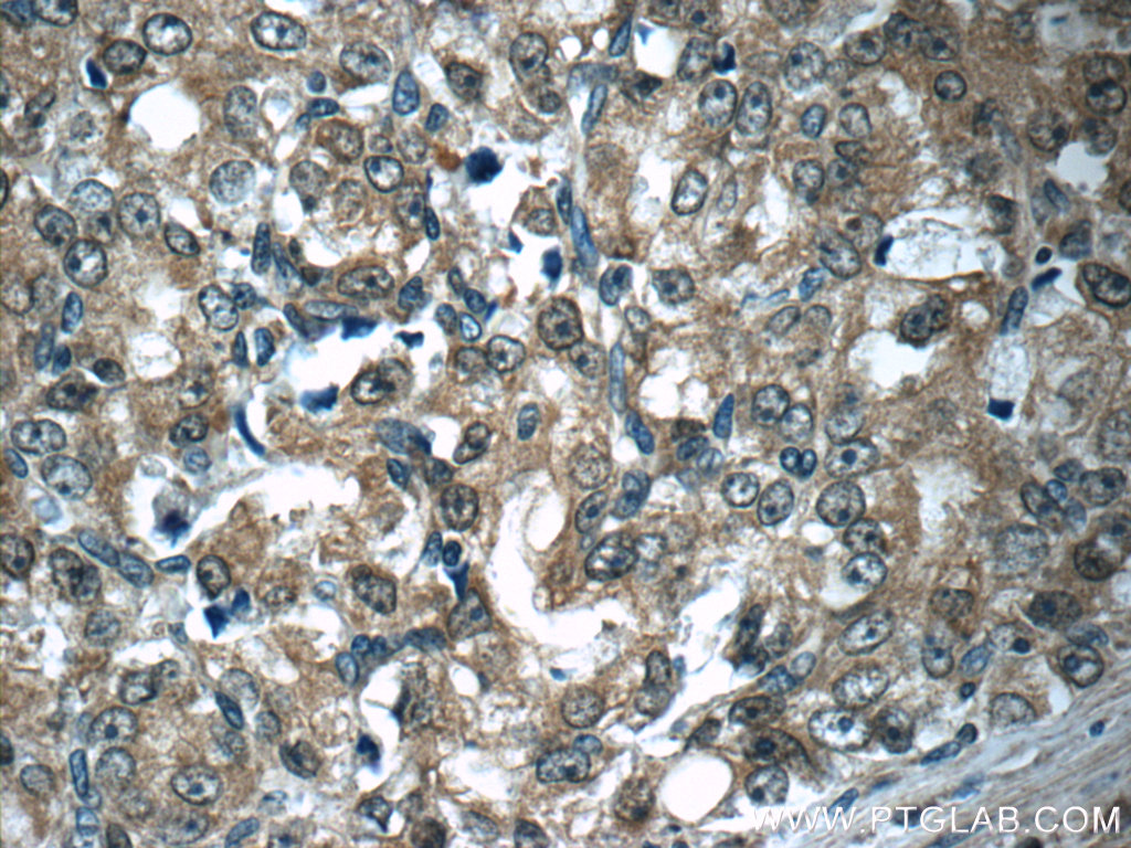 Aminoacylase 1 Polyclonal antibody