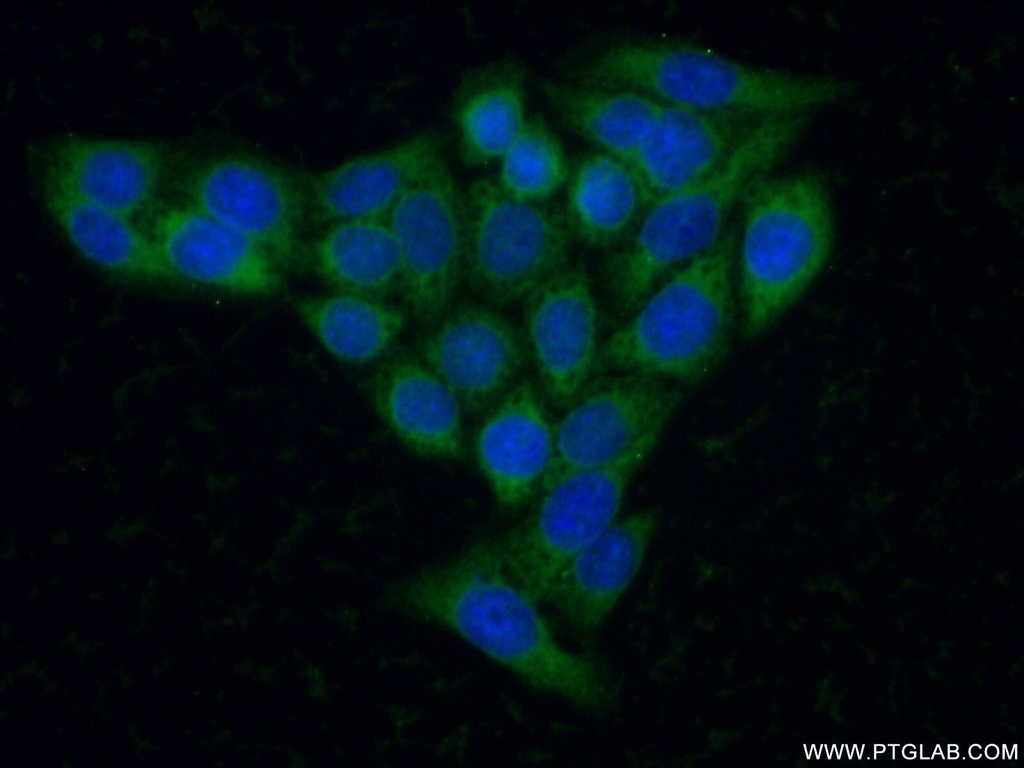 HEXA Polyclonal antibody