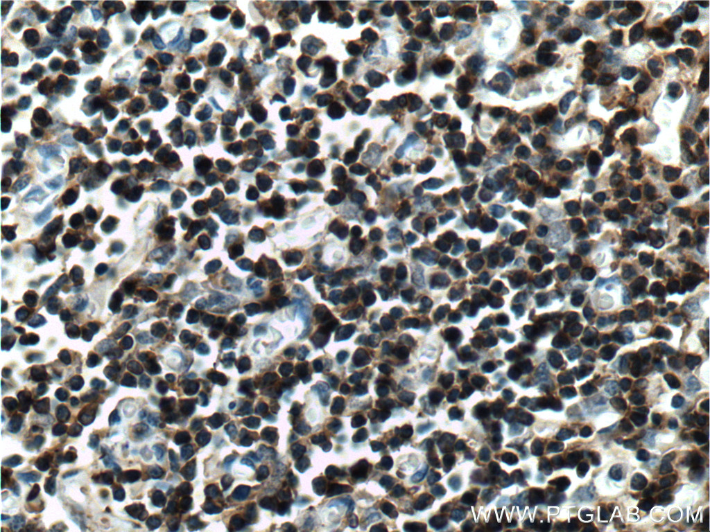 LAT Polyclonal antibody
