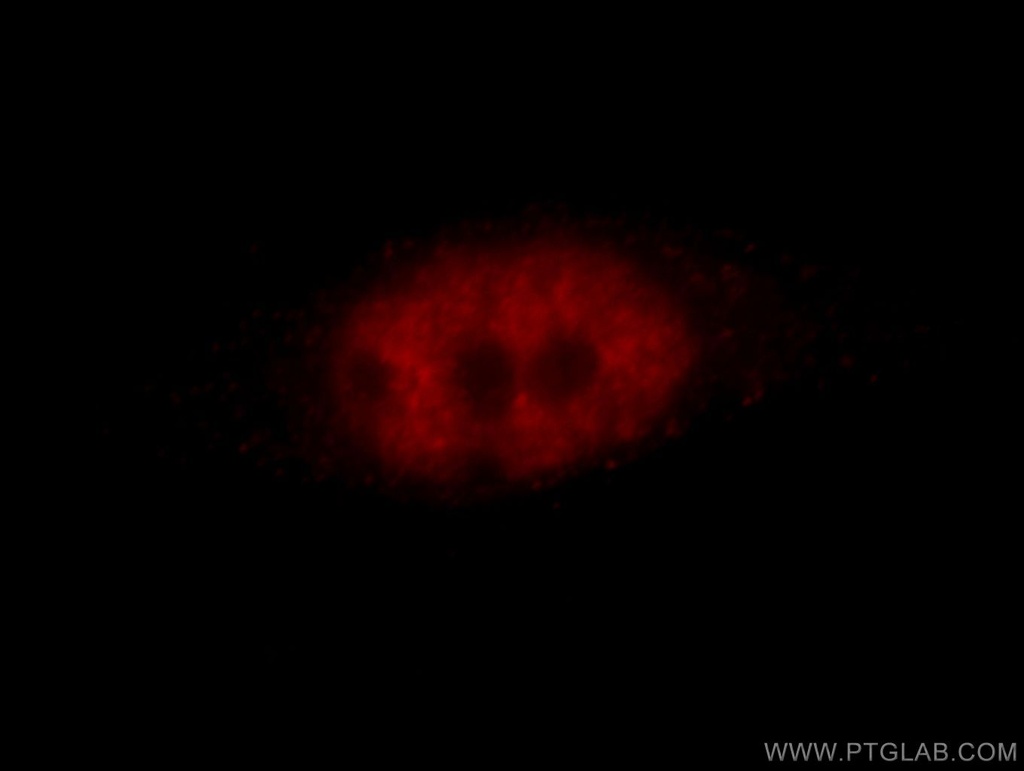 ZBTB7B Polyclonal antibody