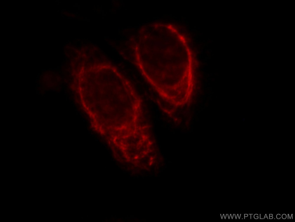 KRT81 Polyclonal antibody