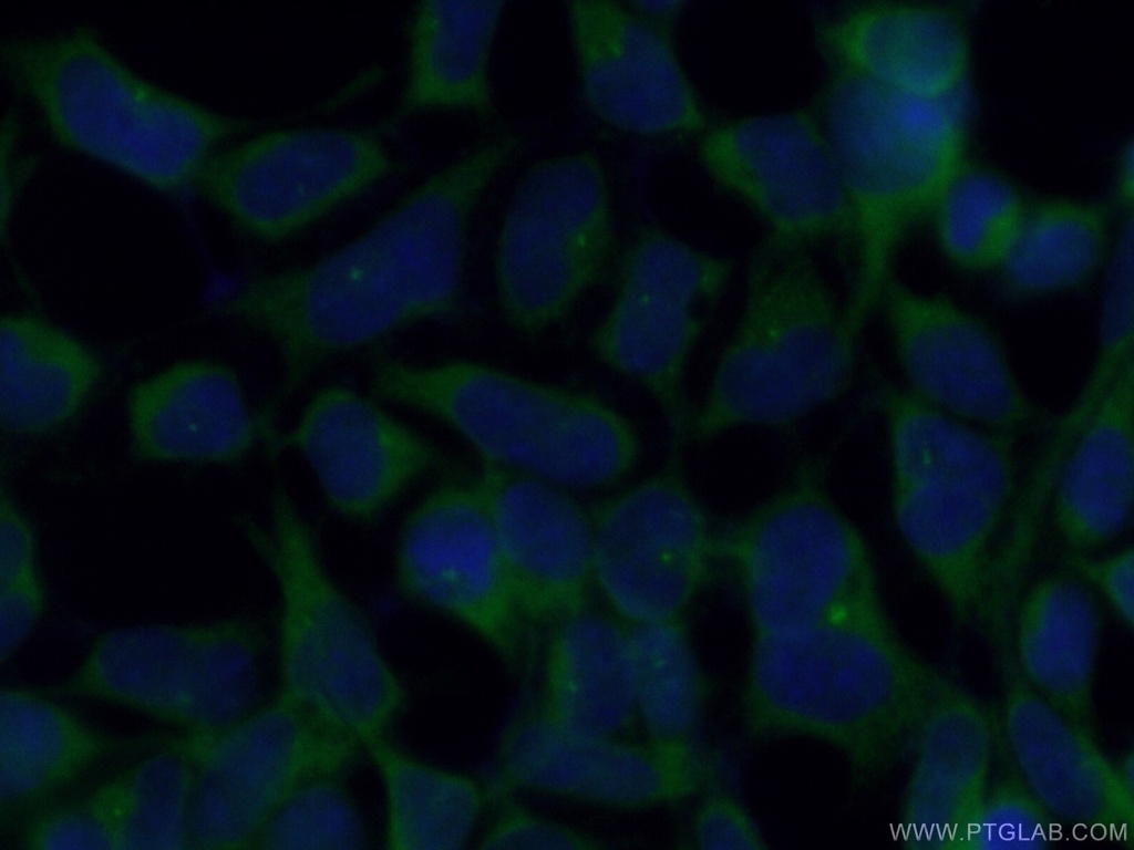 FGFR1OP Polyclonal antibody