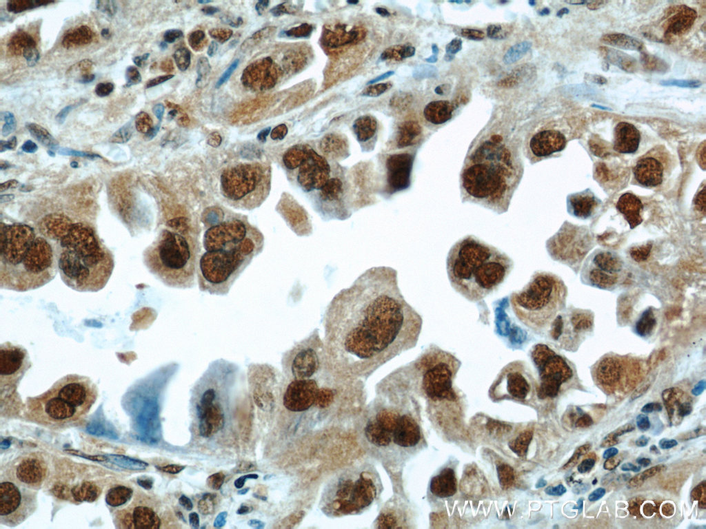 HDGF Polyclonal antibody