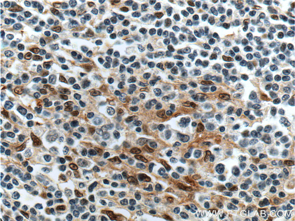 FLI1 Polyclonal antibody