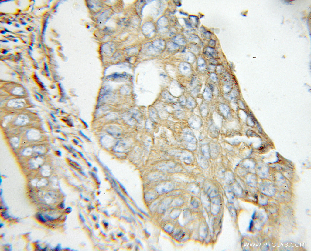 EXT2 Polyclonal antibody