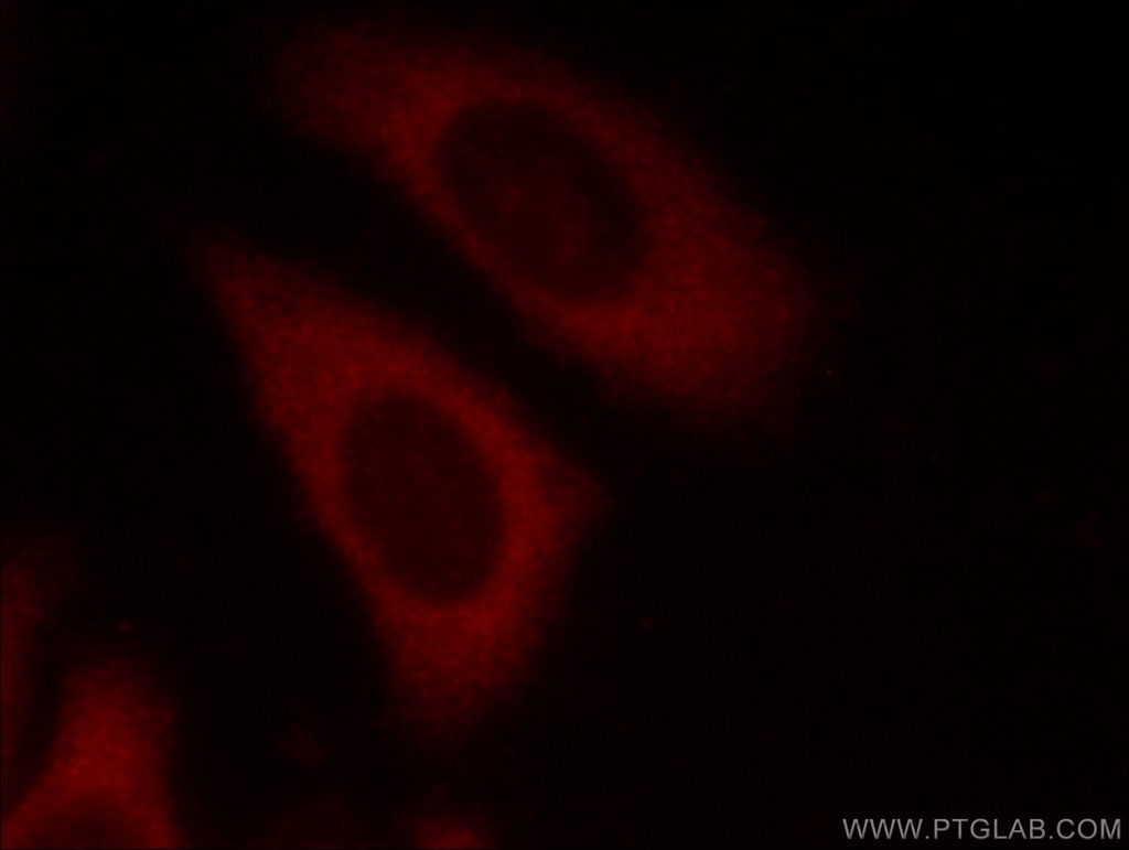 EIF3E Polyclonal antibody