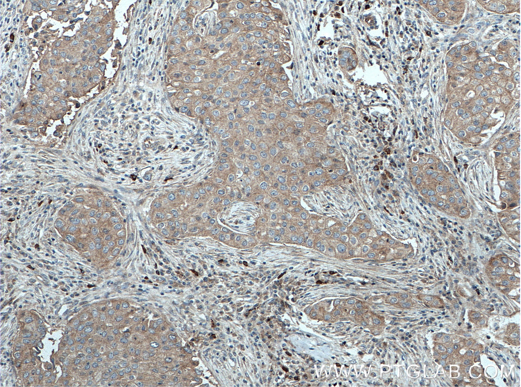 LGP2 Polyclonal antibody
