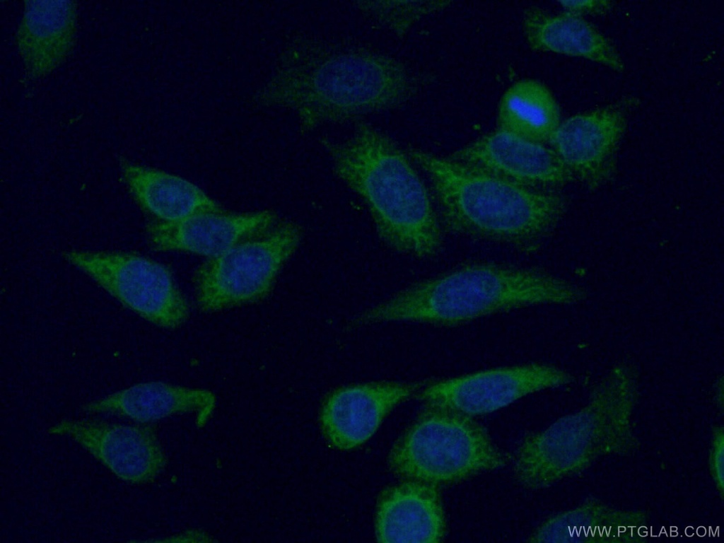 UMP/CMP kinase Polyclonal antibody