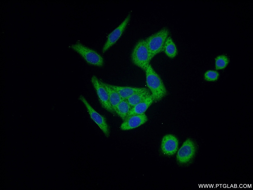 ARHGEF1 Polyclonal antibody