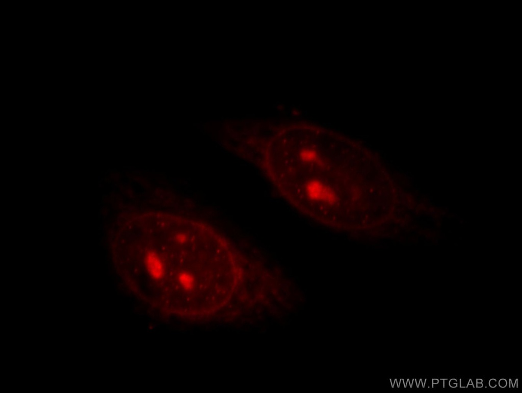 TIN2 Polyclonal antibody