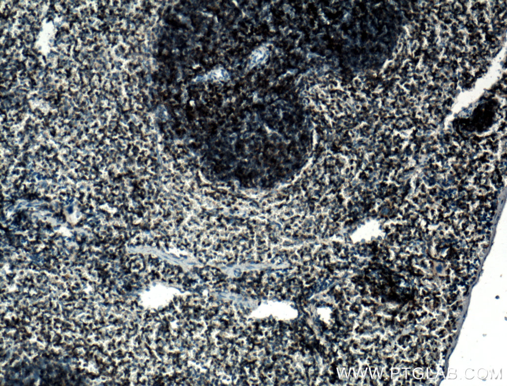 DEF6 Polyclonal antibody