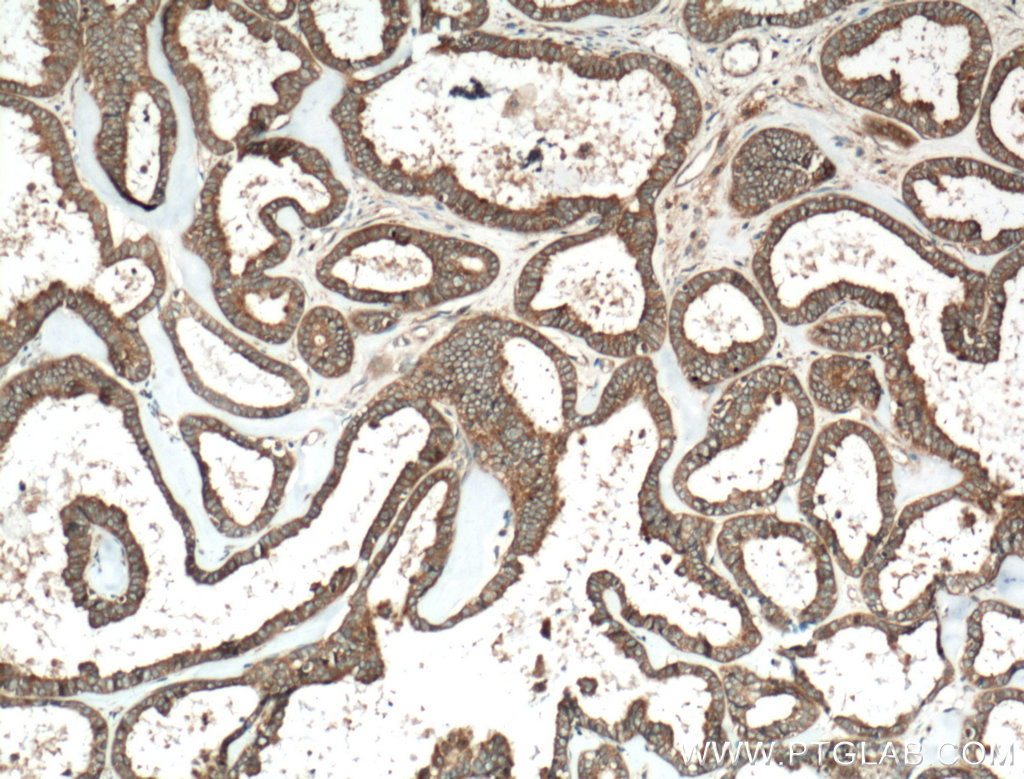 HPS6 Polyclonal antibody