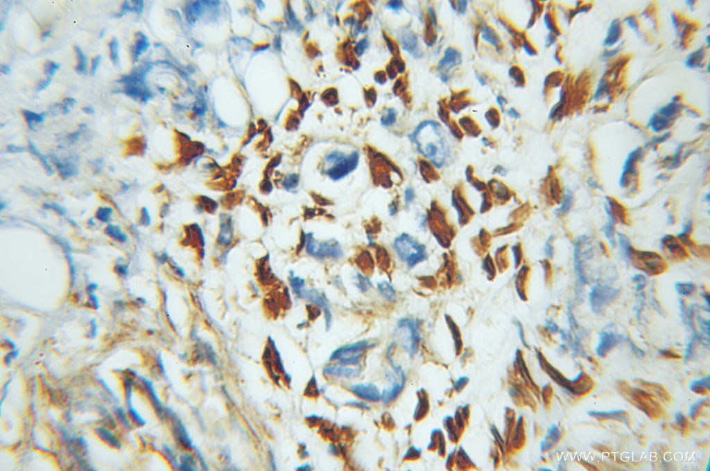 ZNF266 Polyclonal antibody