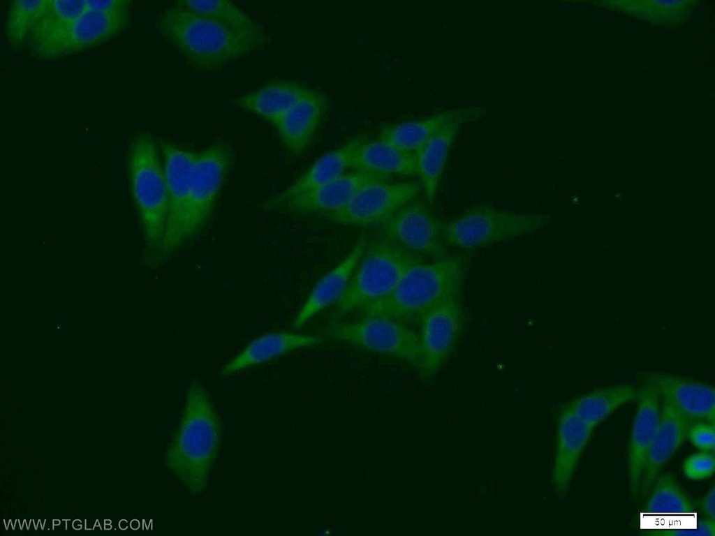 SULT1A4 Polyclonal antibody