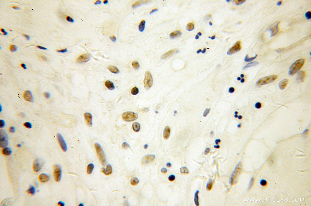SP100 Polyclonal antibody