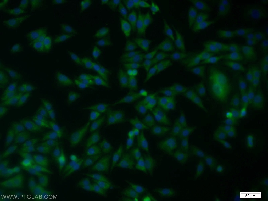 SPRY2 Polyclonal antibody