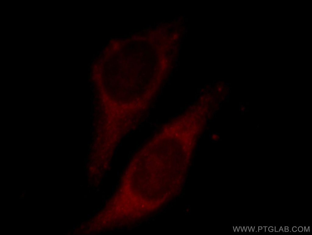 ECH1 Polyclonal antibody