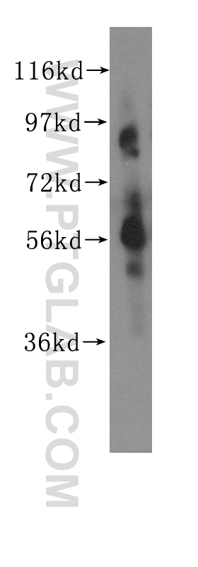 CHRNA6 Polyclonal antibody