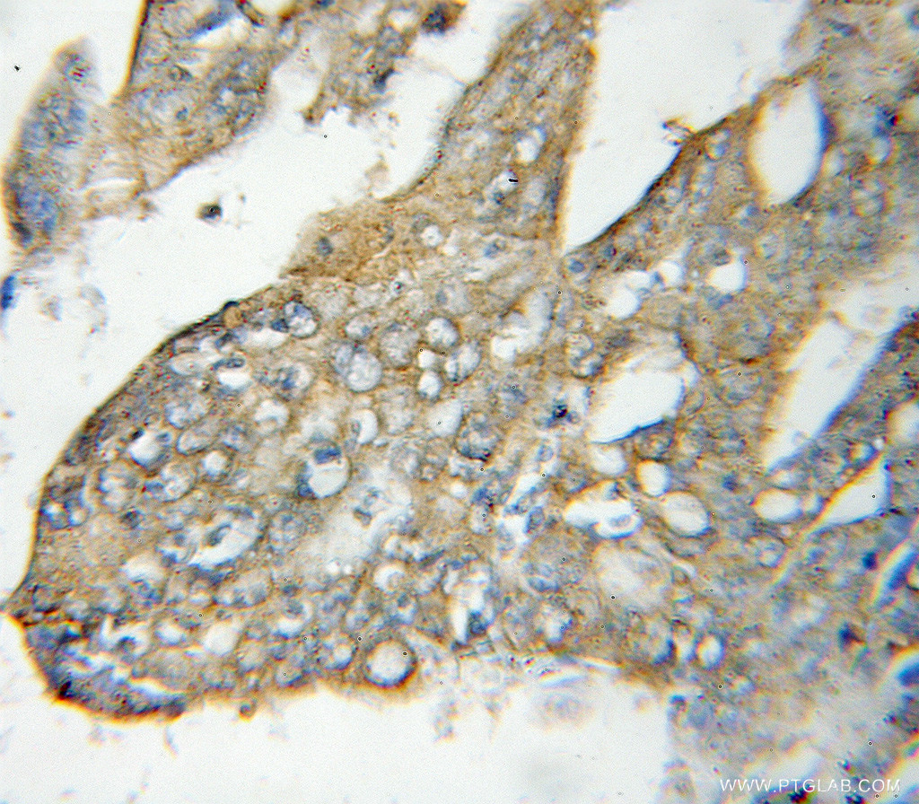 NT5C3 Polyclonal antibody
