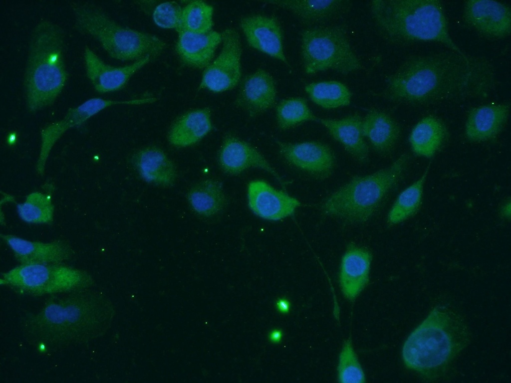 TACC2 Polyclonal antibody