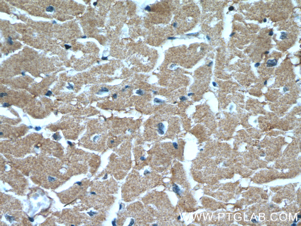 XPO6 Polyclonal antibody