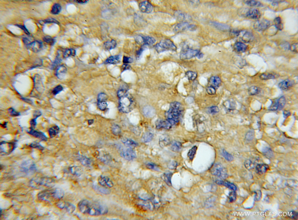 COX7A1 Polyclonal antibody