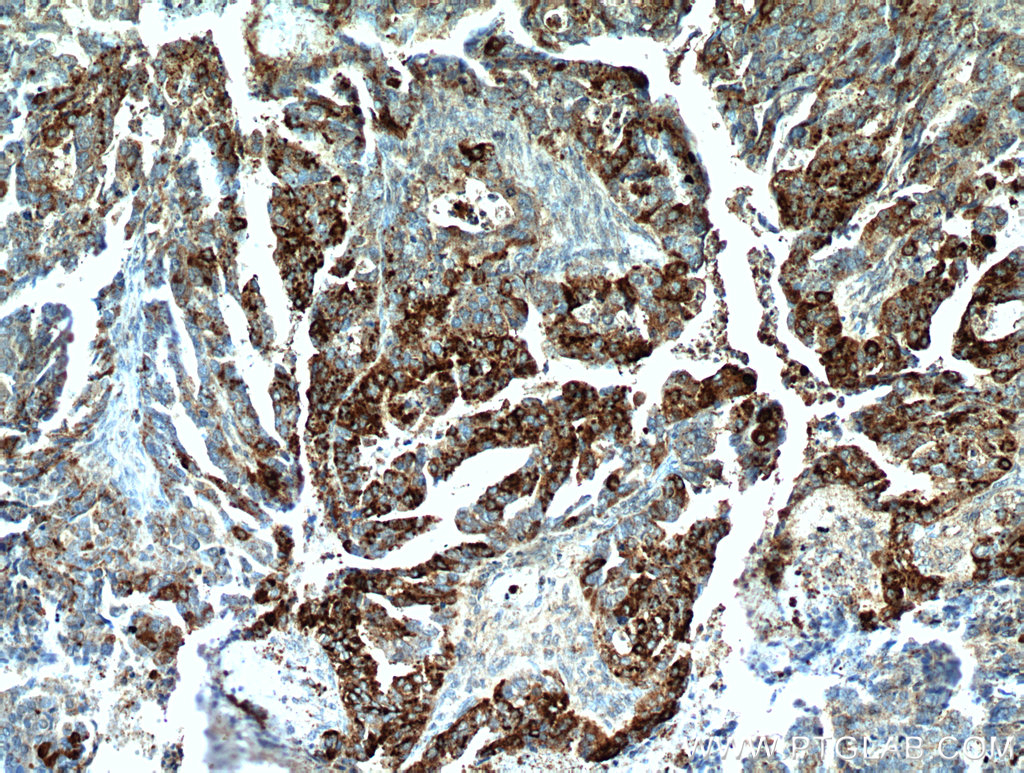 COX7A2L Polyclonal antibody