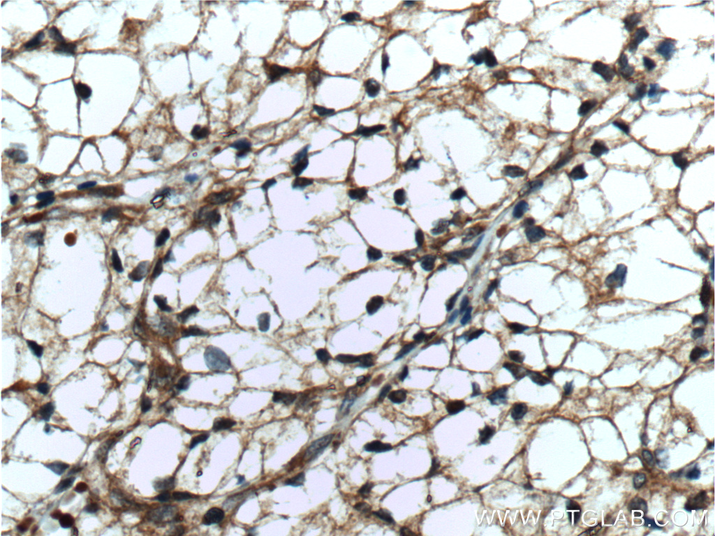 GRK6 Polyclonal antibody