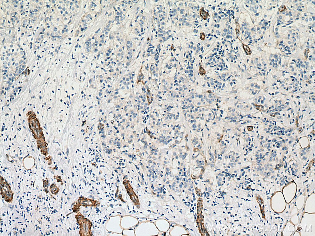 EHD2 Polyclonal antibody