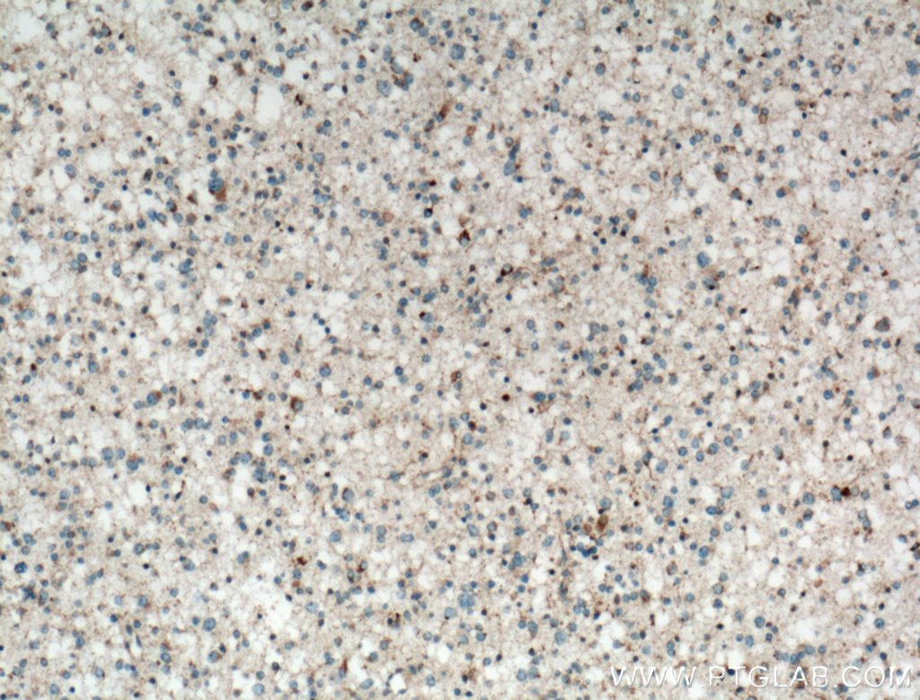 RAB24 Polyclonal antibody