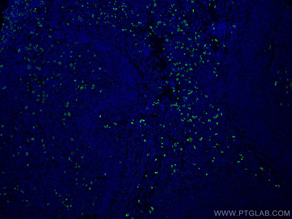 Human IgA Heavy Chain Polyclonal antibody