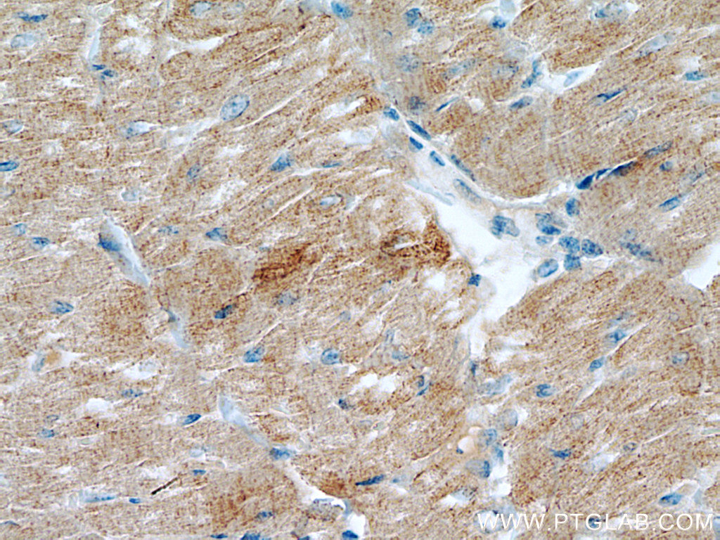 Myozenin 2 Polyclonal antibody