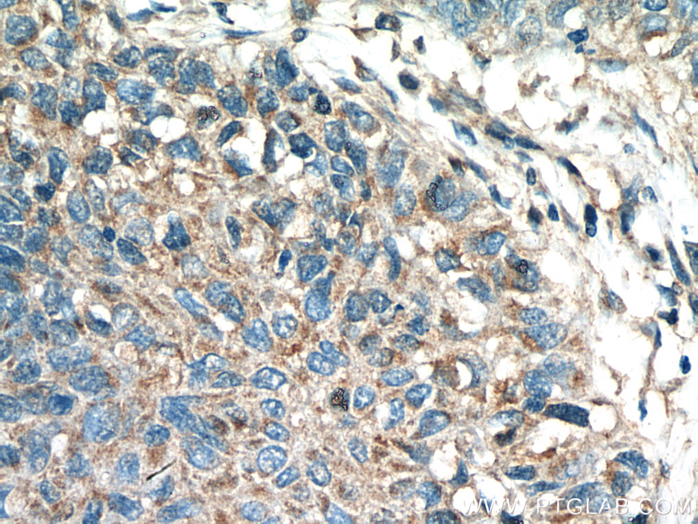 Kindlin 2 Polyclonal antibody