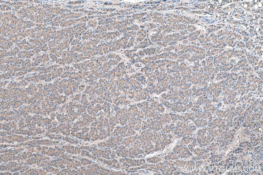 PRUNE2 Polyclonal antibody