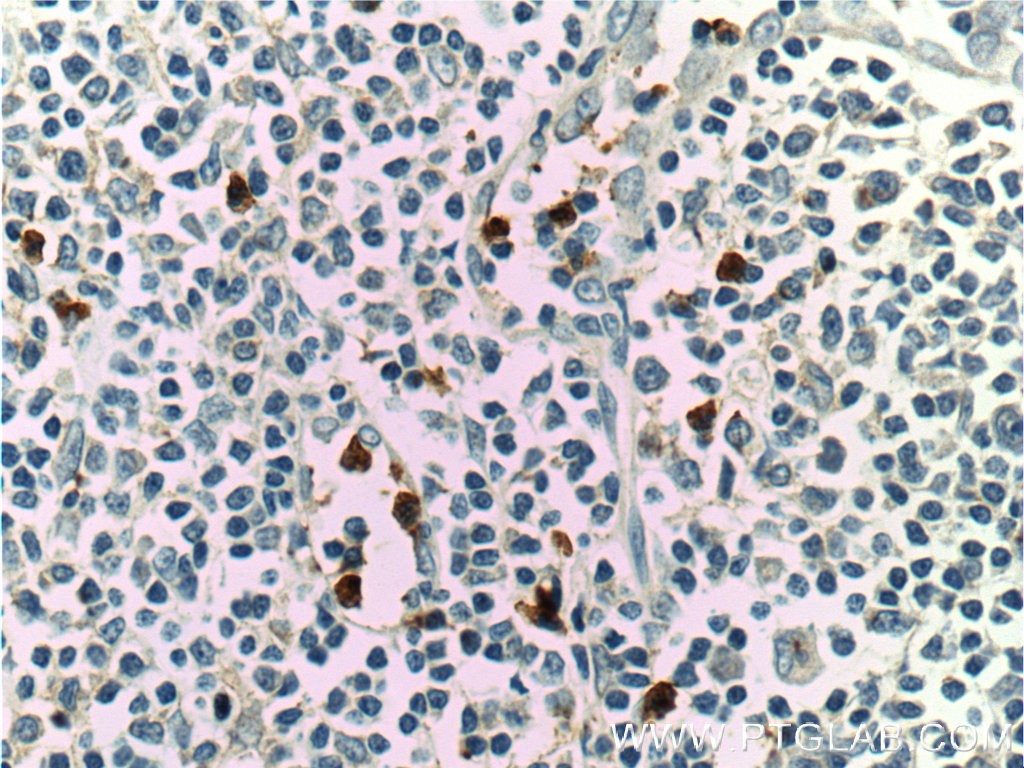 LILRA2 Polyclonal antibody