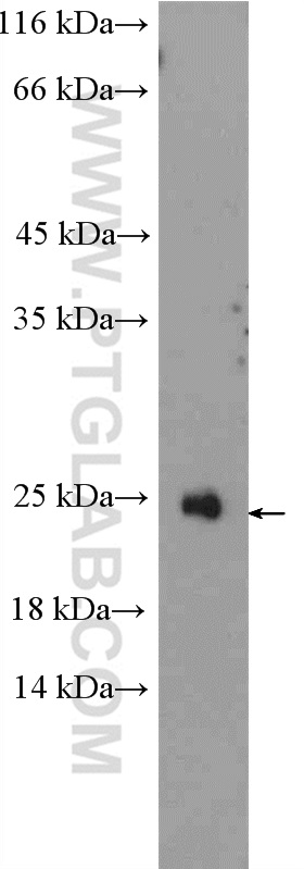 RAX2 Polyclonal antibody