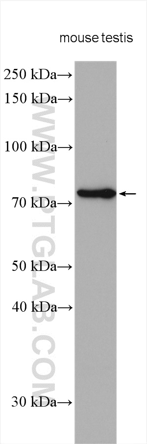 EFHC1 Polyclonal antibody