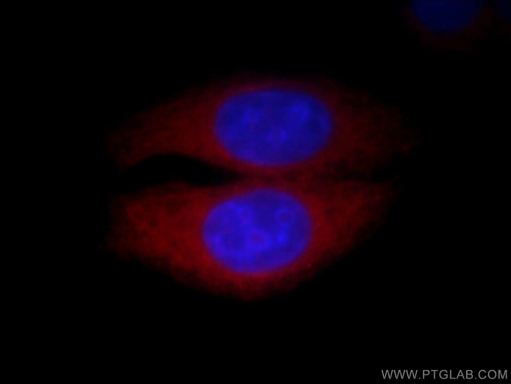 Calpain 2 Polyclonal antibody