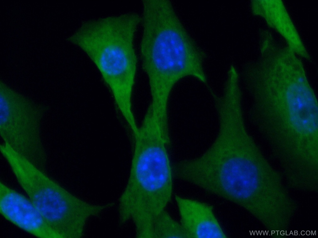 MTAP Polyclonal antibody