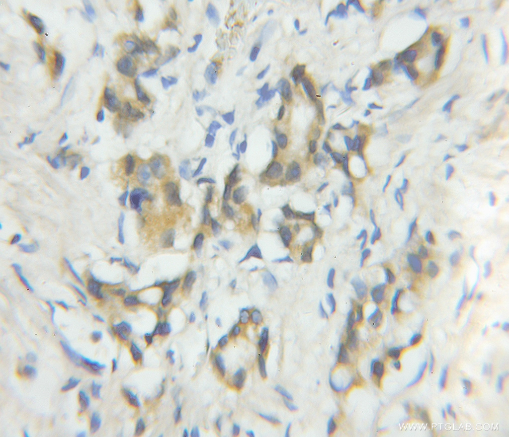 CALN1 Polyclonal antibody
