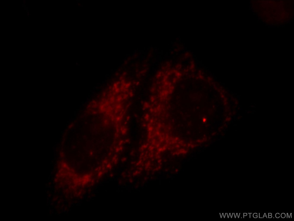 TIMM9 Polyclonal antibody