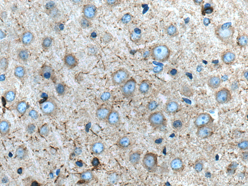 SCN1B Polyclonal antibody