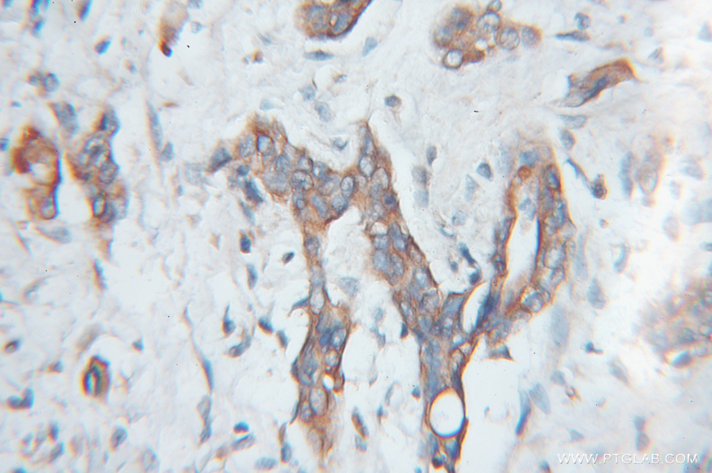 SCMH1 Polyclonal antibody