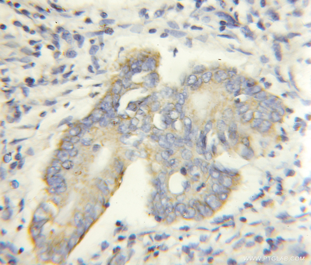 PHACS Polyclonal antibody