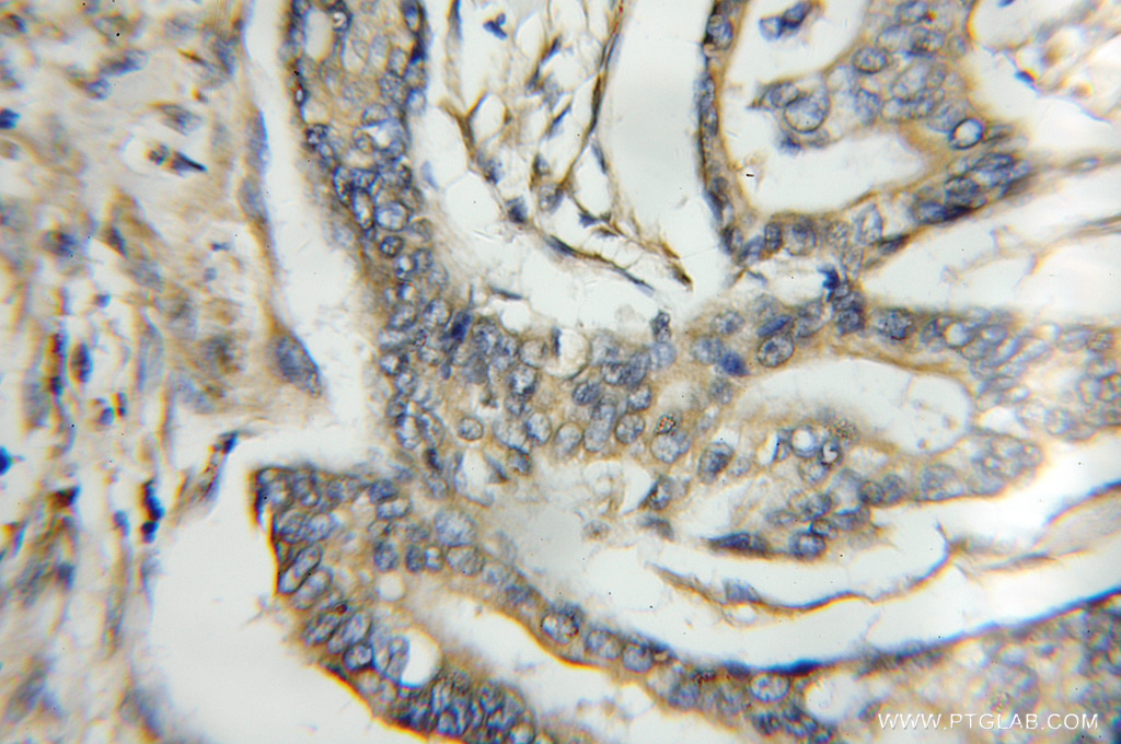 PTPMT1 Polyclonal antibody