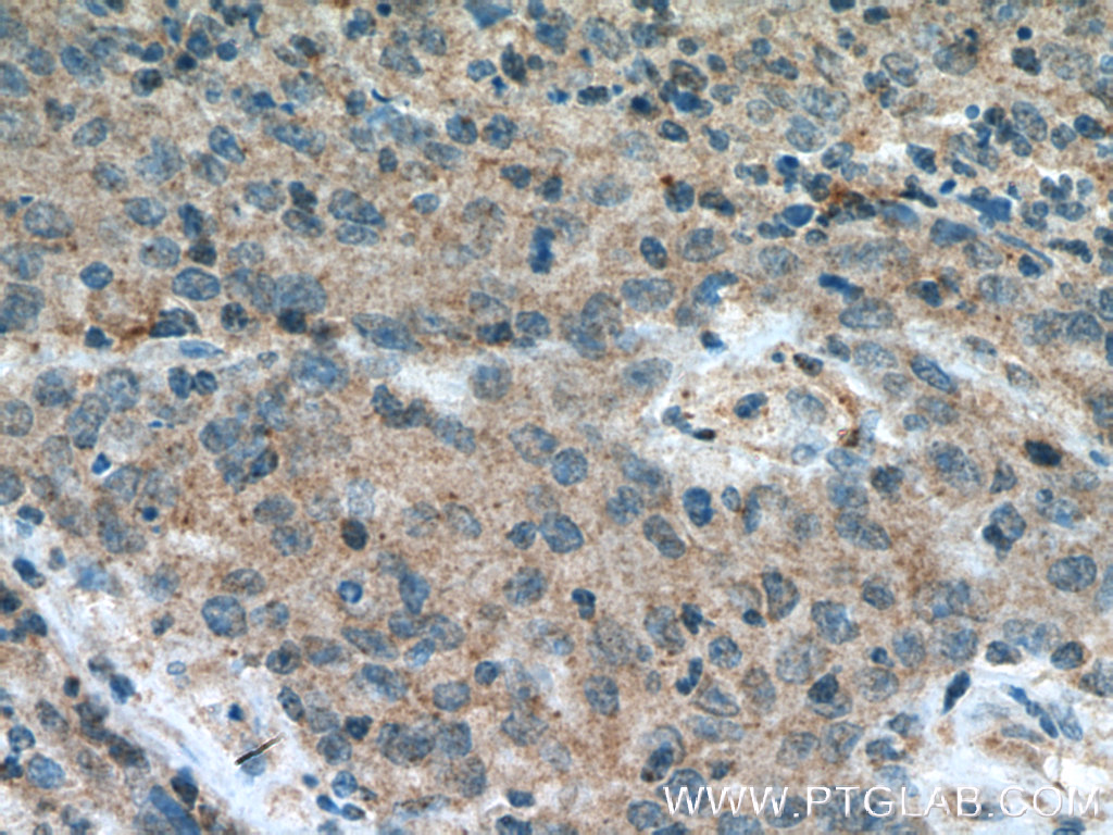 FBXW2 Polyclonal antibody