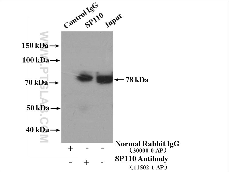 SP110 Polyclonal antibody
