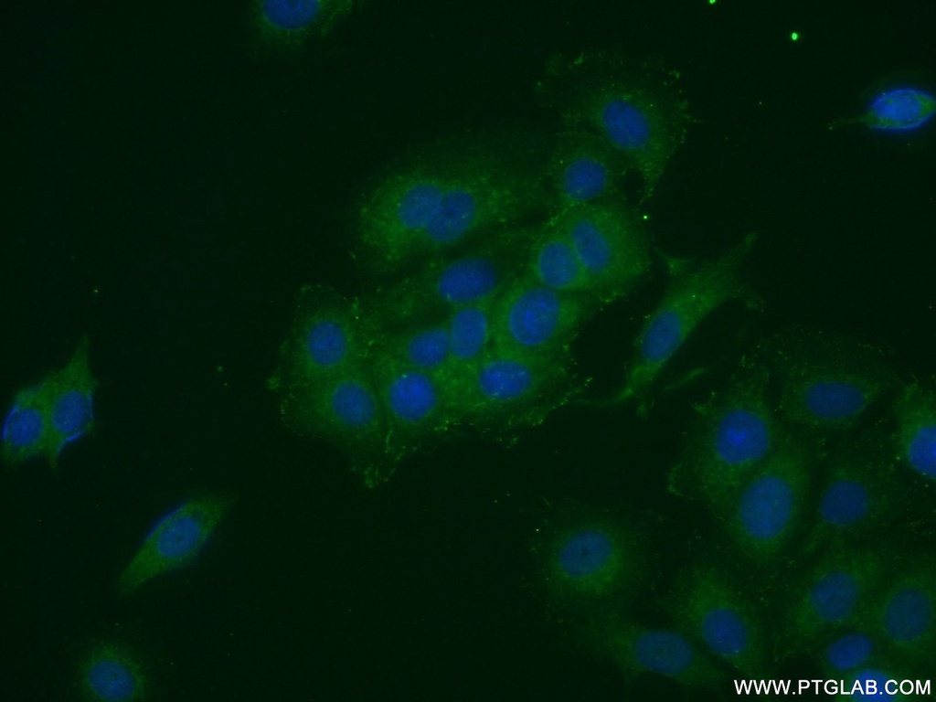 FRS2 Polyclonal antibody