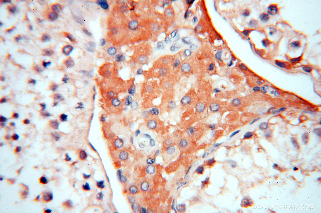 Symplekin Polyclonal antibody