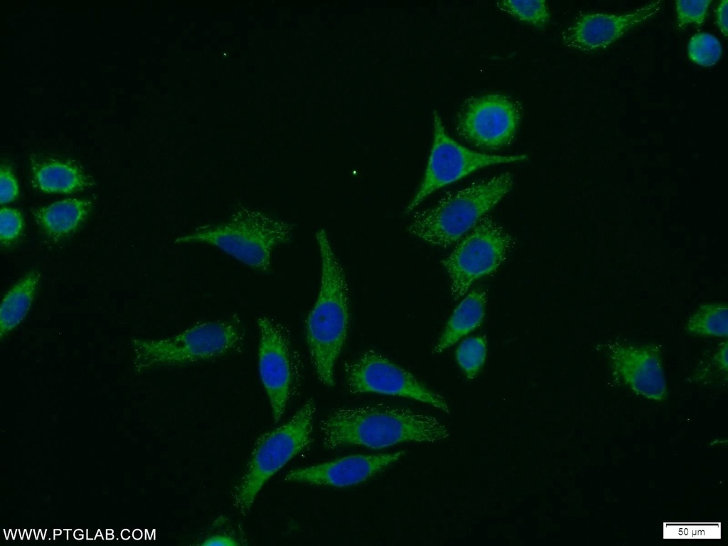 MCC Polyclonal antibody